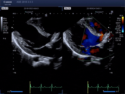 2D-and-Color-Doppler.gif 2D-and-Color-Doppler.gif