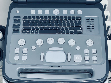 Siemens Acuson P500
