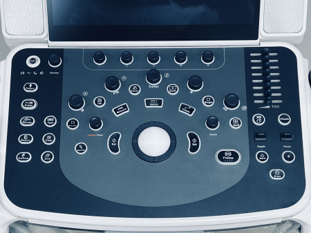 Mindray DC-70Exp X-insight